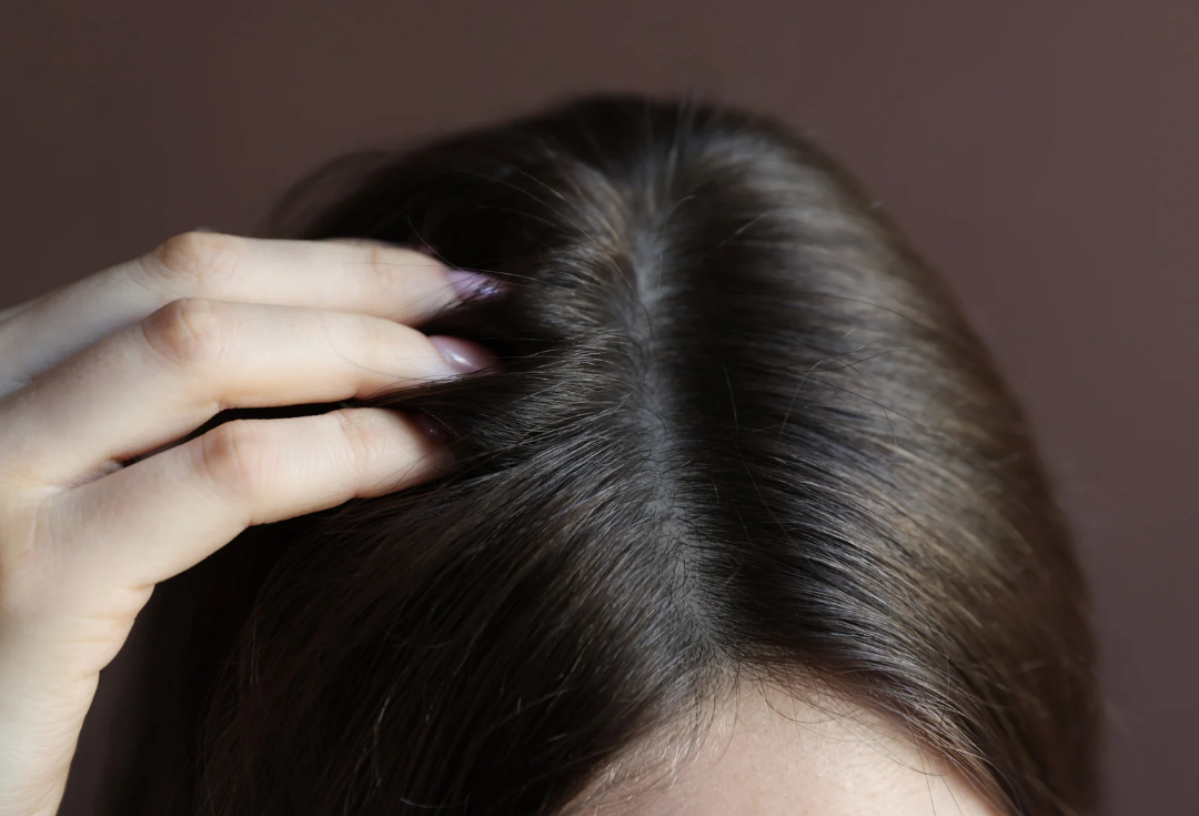 Scalp Ageing: The Early Signs Most People Overlook